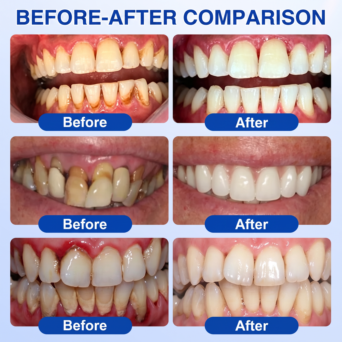 🇬🇧NATRAVOR® 🦷GumRevive periodontal repair gel🌲
