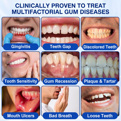🇬🇧NATRAVOR® 🦷GumRevive periodontal repair gel🌲