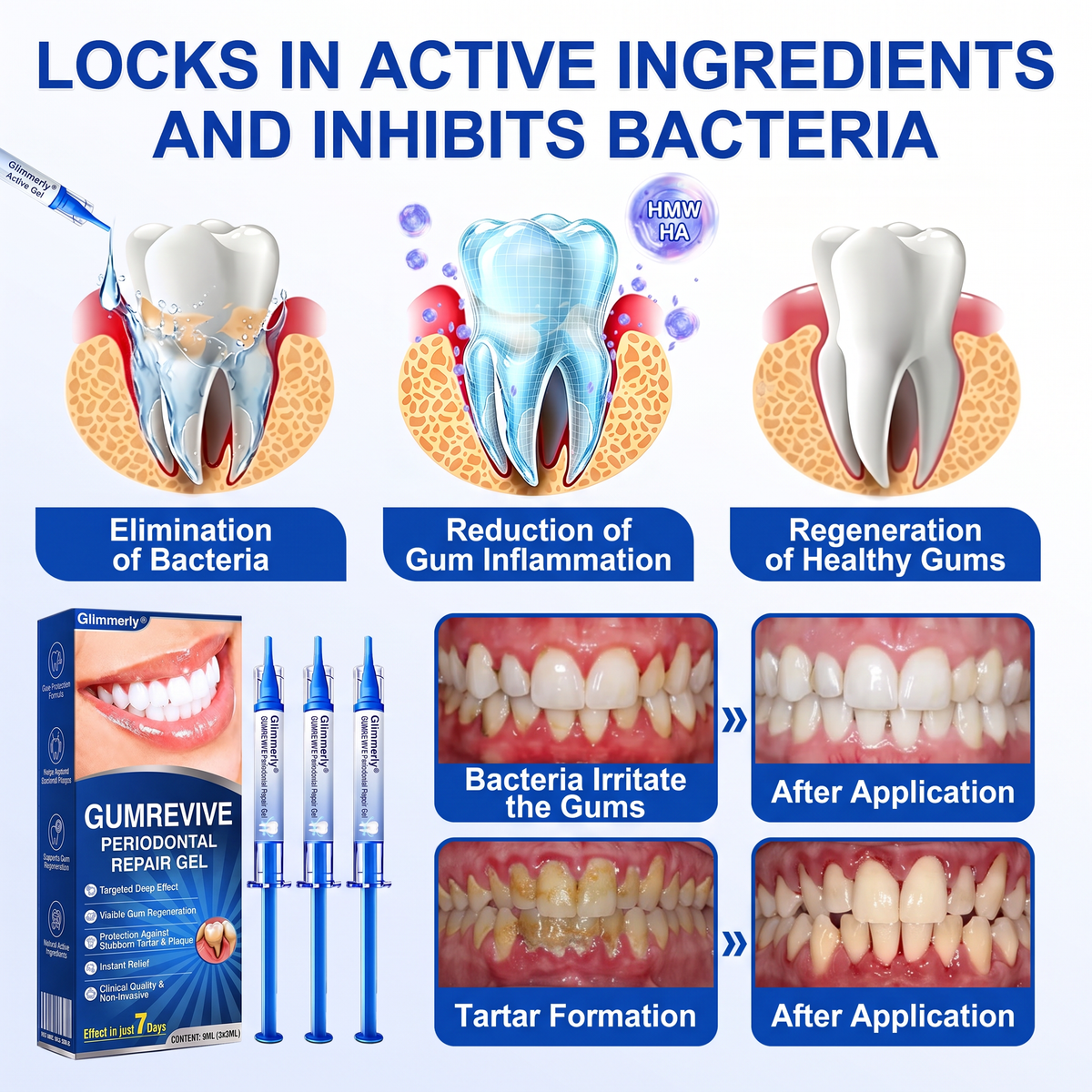🇬🇧NATRAVOR® 🦷GumRevive periodontal repair gel🌲