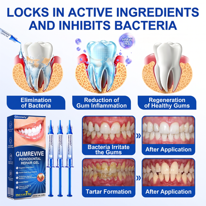 🇬🇧NATRAVOR® 🦷GumRevive periodontal repair gel🌲